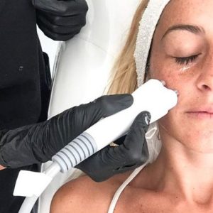 Venus Legacy - Thermolifting