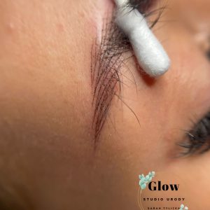 Włos maszynowy - rekonstrukcja brwi